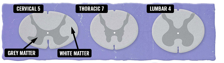 1.3_White&GreyMatter2